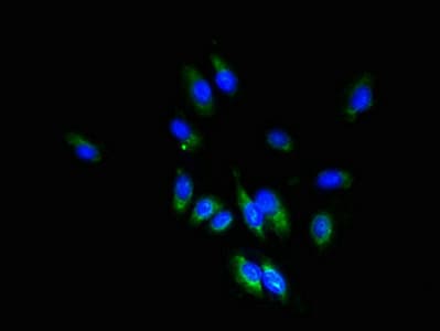 Polyclonal Rabbit anti-Human TSPAN1 / TM4SF Antibody (IHC)