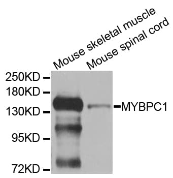 Polyclonal Rabbit anti-Human MYBPC1 Antibody (WB)