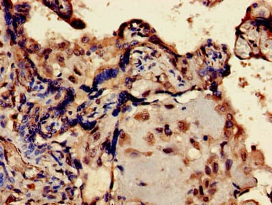 Endogenous Retrovirus HERV-K10 putative protease Antibody