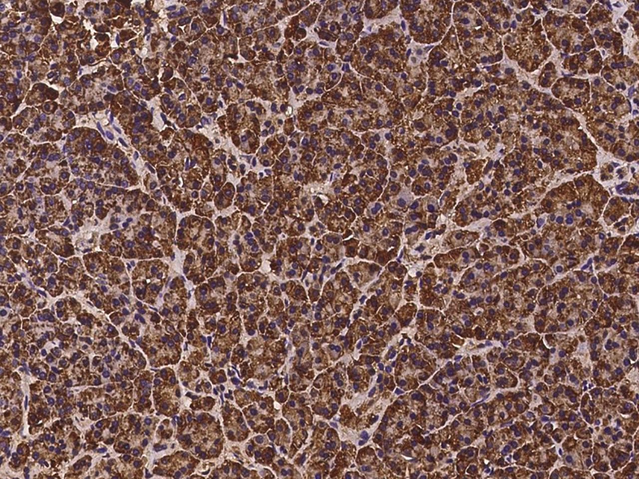 ZNF195 Antibody