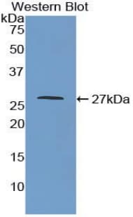 MAOA / Monoamine Oxidase Antibody (aa229-428)