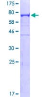 Human CAP1 Protein (Recombinant GST)