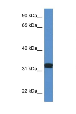 DDO / D-Aspartate Oxidase Antibody (aa185-234)