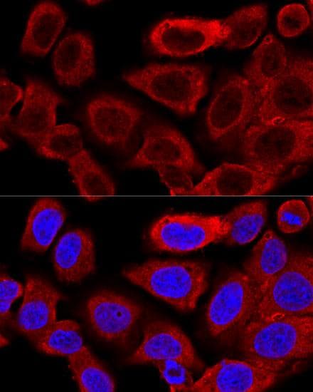 DNM1L / DRP1 Antibody