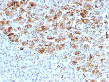 Alpha-1-Antichymotrypsin Antibody (clone AACT/1452)