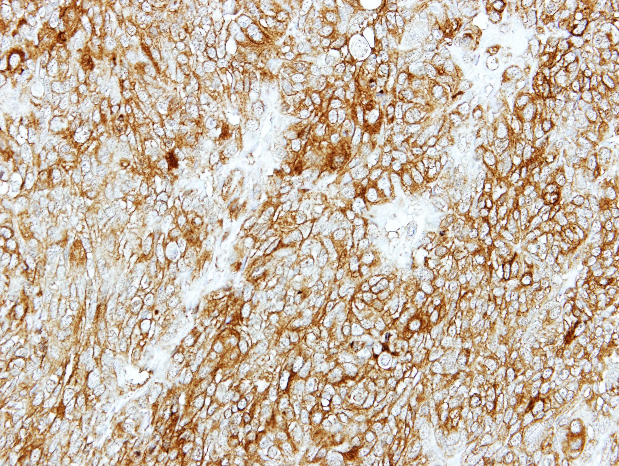 GMDS / GMD Antibody (aa67-357)