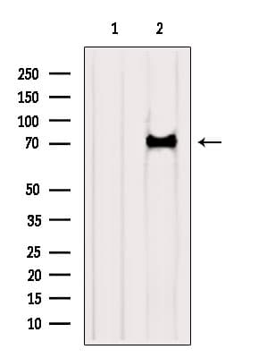 Polyclonal Rabbit anti-Human KATNB1 Antibody (WB)