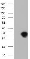 QPRT Antibody (clone OTI4B3)