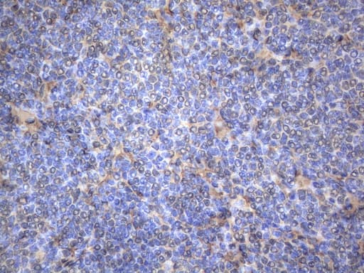 Monoclonal Mouse anti-Human MAP3K8 / TPL2 Antibody (clone OTI2E3, aa277-461, IHC, WB)
