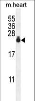 AP1S3 Antibody (aa8-37)