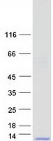 Human SPINK7 / ECRG2 Protein (Recombinant Myc-DDK (Flag))