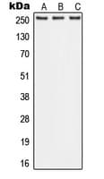 ABCA1 Antibody (Internal)