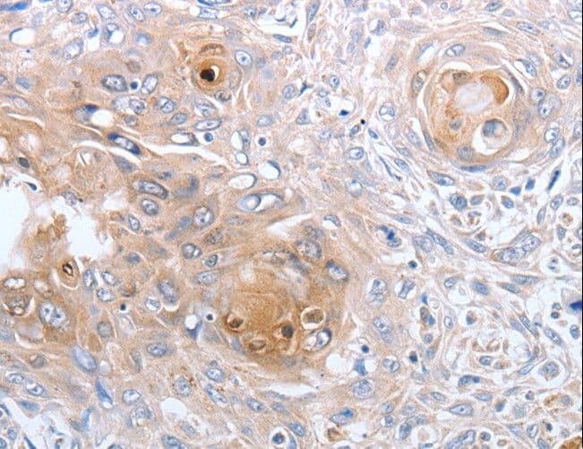 Polyclonal Rabbit anti-Human CASP12 / Caspase 12 Antibody (IHC)