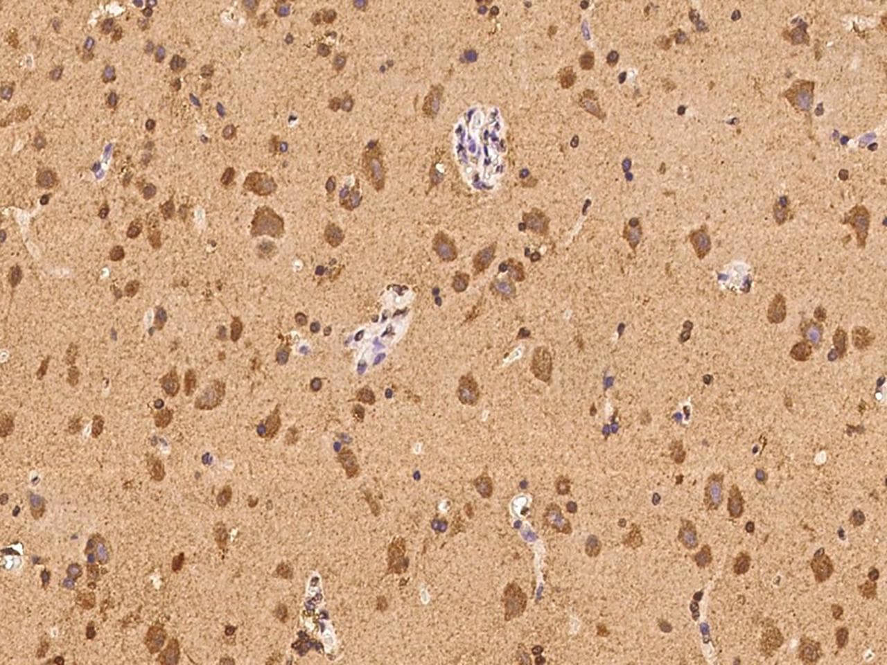 ABCC8 / SUR1 Antibody