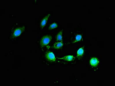 BCL2 / Bcl-2 Antibody