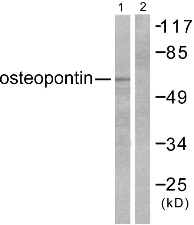 Polyclonal Rabbit anti-Human SPP1 / Osteopontin Antibody (WB)