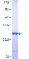 Human TPR Protein (Recombinant GST, N-terminus)