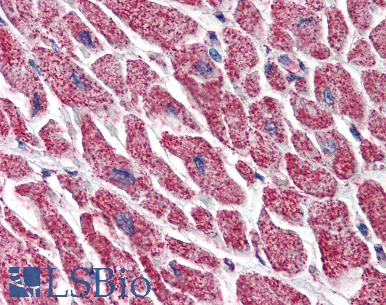 IHC-plus™ Monoclonal Mouse anti-Human HSP90B1 / GP96 / GRP94 Antibody (clone 2H3, aa676-803, IHC, IF, WB)