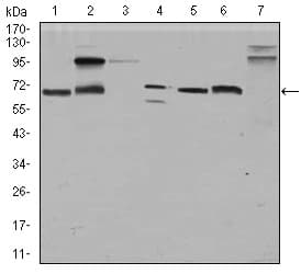 Monoclonal Mouse anti-Human GPC3 / Glypican 3 Antibody (clone 9C2, aa55-200, IHC, IF, WB)