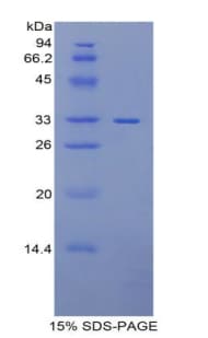 Rat PITRM1 / MP1 Protein (Recombinant His)