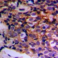 IF3mt / MTIF3 Antibody (Internal)