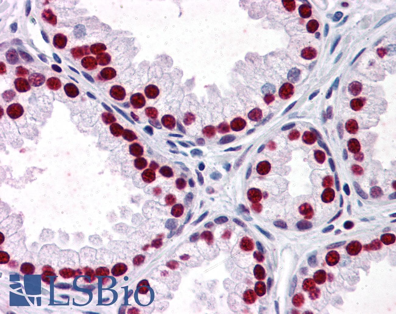 IHC-plus™ SMAD6 Antibody (clone 4F3)