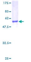 Human NNMT Protein (Recombinant GST)