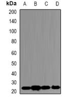 PSMB5 Antibody