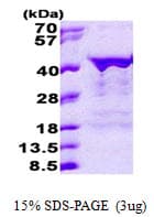 Human MSI2 Protein (Recombinant His, N-Terminal)