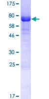Human TSSC4 Protein (Recombinant GST)