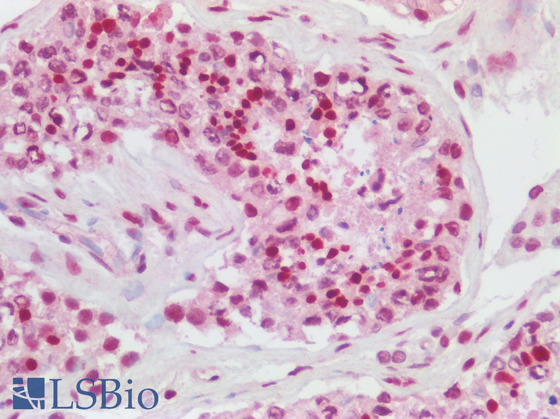 IHC-plus™ HDGFRP2 Antibody (aa425-475)