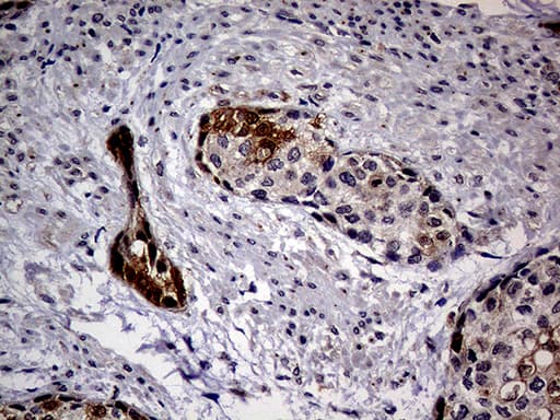 p16INK4a / CDKN2A Antibody (clone OTI4H4, Carrier-free)