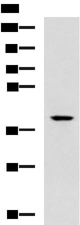 TDP2 / TTRAP Antibody