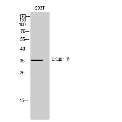 C/EBP Beta / CEBPB Antibody (180-260 aa)
