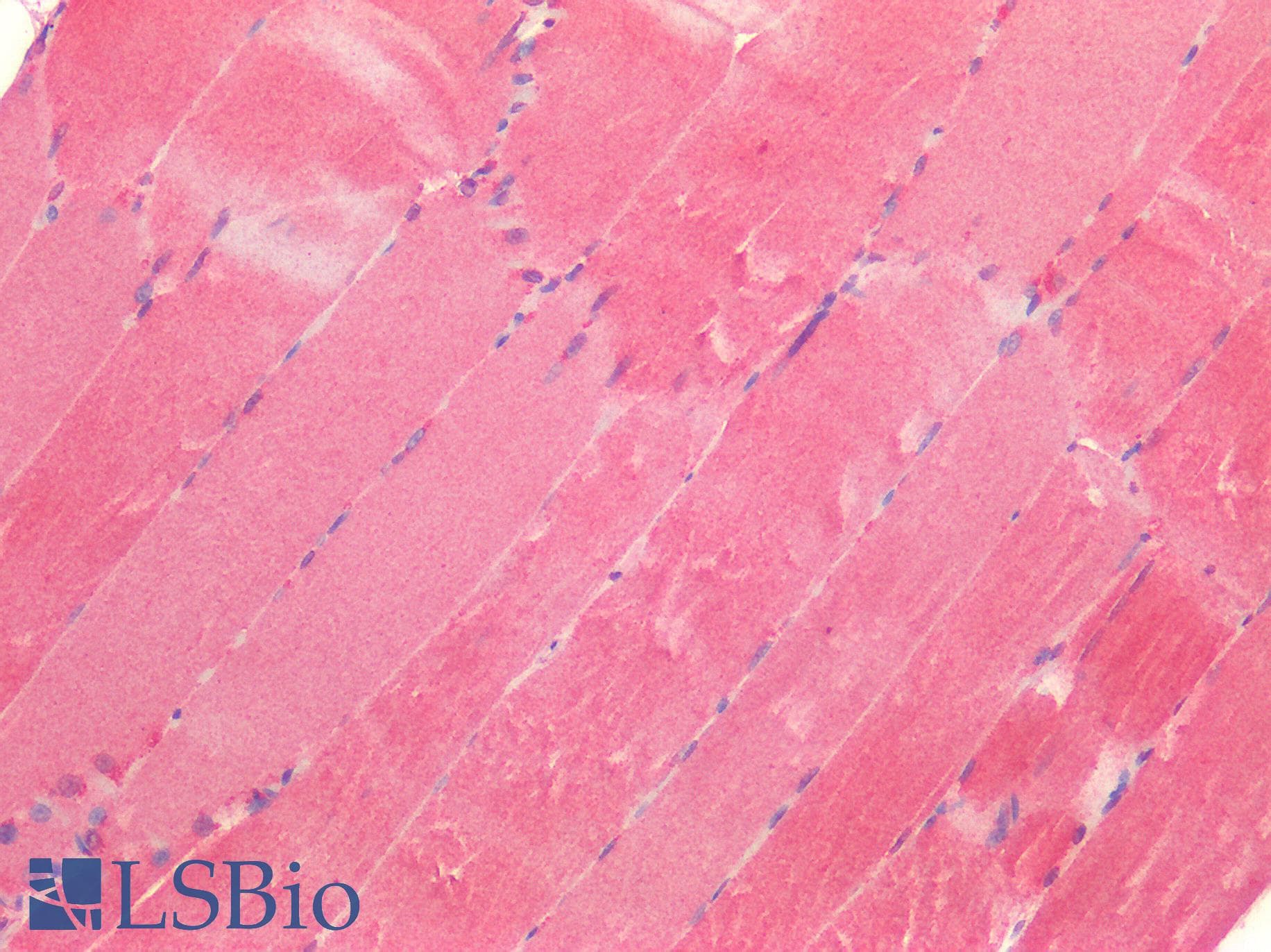 IHC-plus™ CX3CL1 / Fractalkine Antibody