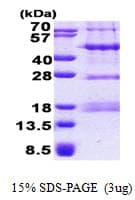 Human PHF13 Protein (Recombinant His)