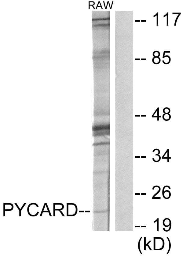 Polyclonal Rabbit anti-Human PYCARD / ASC / TMS1 Antibody (IHC, WB)