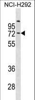 COL9A3 / Collagen IX Antibody (aa501-528)