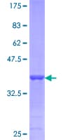 Human APOB / Apolipoprotein B (Recombinant GST, N-terminus)