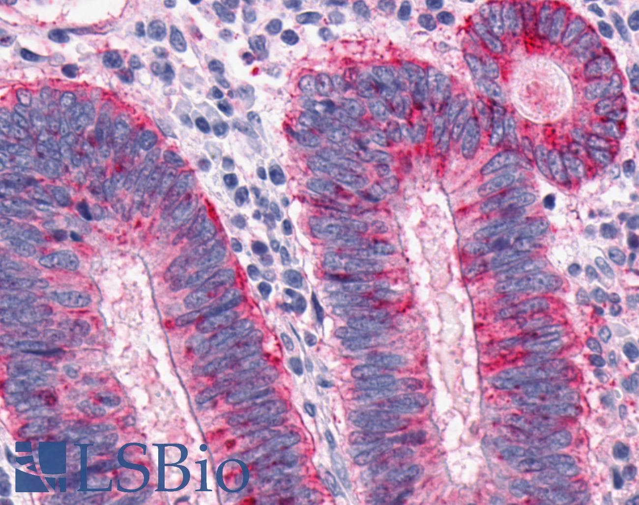 PathPlus™ Polyclonal Rabbit anti-Human MCHR1 Antibody (N-Terminus, IHC)