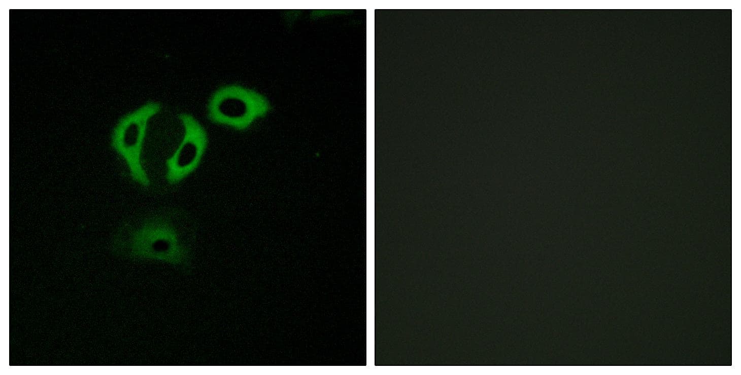ERIC-1 / TACC3 Antibody
