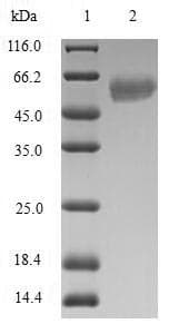 Human RAD51L3 / RAD51D Protein (Recombinant GST, N-terminus)