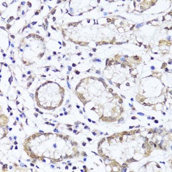 Polyclonal Rabbit anti-Human EGLN1 + EGLN2 Antibody (IHC)