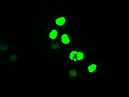 Monoclonal Mouse anti-Human MYC / c-Myc Antibody (clone OTI1A6, IHC, IF, WB)
