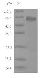 Mouse CBS Protein (Recombinant 6His, N-terminus)