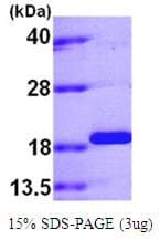 Human PPIL1 Protein (Recombinant His)
