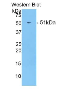 PRSS8 / Prostasin Antibody (aa124-342)