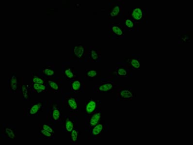 TBL1X / TBL1 Antibody