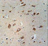 WDPCP / FRITZ Antibody (aa676-705)