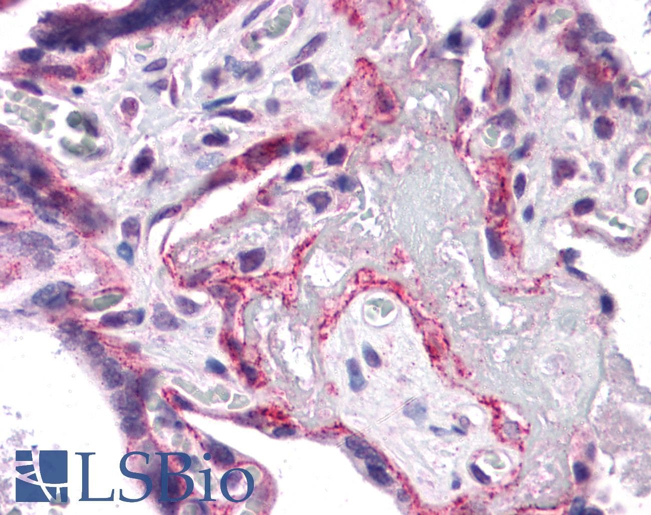 IHC-plus™ PIAS1 Antibody
